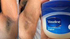 Remove unwanted hair in 2 minutes with vaselinetf6ttgtt5rtttttyyytyyyyghg55b hhh vhgghu bjhư jjy Half Table, Hair Remove, Hair Removal Diy, Natural Hair Removal, Remove Unwanted Hair, Unwanted Facial Hair, Remove Hair, Gram Flour, Facial Hair Removal