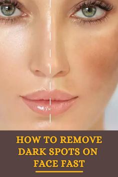 Diy Serum, Acne Prone Skin Care, Dark Spots On Face, Brown Spots Removal, Brown Spots On Face, Spots On Face, Baking Soda Shampoo, Dark Under Eye, Saggy Skin