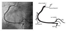 an x - ray view of the left side of a foot and right side of a vein