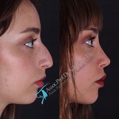 Job Inspiration, Best Plastic Surgeons, Nose Makeup, Perfect Nose