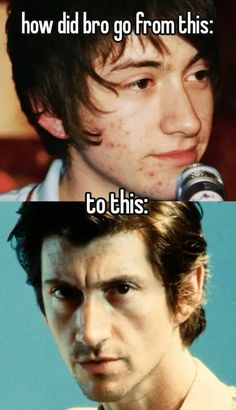 (i still love fetus al btw) [mine - repost with creds] #alexturner #glowup #arcticmonkeyswhisper #tlsp Tranquility Base, Monkey 3, Artic Monkeys, Best Albums, Alex Turner, Arctic Monkeys, Glow Up?, Pins