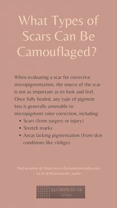Whatever your concern, whether it be, stretch marks or maybe you have a scar that’s bothering you. Please feel free to reach out so that we can schedule a consult. I would love to help you gain yourself confidence back. Elena @ Illusions by Ink Studio Paramedical Tattoo, Scalp Micropigmentation, Beauty Bar, Skin Tightening, What Type, Beauty Treatments, Skin Conditions, Color Correction, Microblading