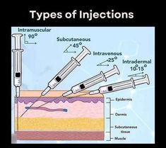 the diagram shows different types of injections