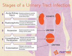 stages of a urinary tact infection diagram with labels on it