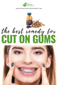 The Best Remedy for Cut on Gums - My Natural Treatment 🌿 #cutongum Gum Health Remedies Natural Treatments, Healthy Mouth, Natural Toothpaste, Receding Gums, Gum Health, Dental Surgery, Simple Home, Aloe Vera Gel