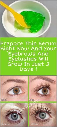 Prepare This Serum Right Now And Your Eyebrows And Eyelashes Will Grow In 3 Days Grow Eyebrows Faster, Grow Eyebrows, Eyebrows And Eyelashes, How To Grow Eyelashes, Long Eyelashes, Classic Feminine, Bald Head