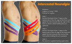 Kinesiology taping instructions for Intercostal Neuralgia #ktape #intercostalneuralgia #ares Kt Tape Ribs, Intercostal Neuralgia, Feel Energized