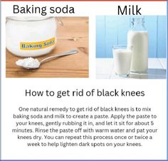 How To Lighten Knees, Dark Knees, Dark Elbows, Dark Underarms, Remove Dark Circles, Baking Soda Uses, Lighten Dark Spots, Dark Circles Under Eyes, Remove Dark Spots