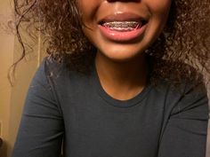 Braces Colors With Rubber Bands, Braces Colors Black Women, Braces Hot Pink, Red Rubber Bands Braces, Braces With Rubber Bands, Braces With Power Chains, Braces Power Chain, Braces Pink Bands, Pink Power Chain Braces