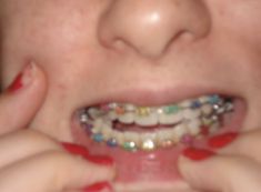 Braces Colors, Mabel Pines, Gravity Falls, Braces, Gravity, My Little Pony, Social Network, Close Up, We Heart It