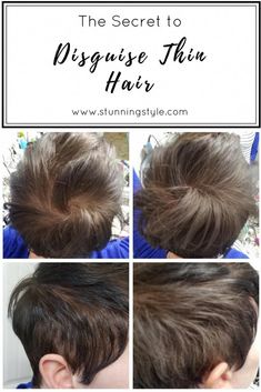 Hairstyles Thinning Hair On Top, Hide Thinning Hair For Women, Haircuts To Hide Thinning Hair, How To Hide Thinning Hair For Women, Bariatric Haircuts, Hairstyles For Thinning Hair On Top For Women, Hairstyles For Loss Of Hair, Hairstyles For Thinning Hair On Top, Hairloss Hairstyles