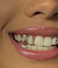 a close up of a woman's smile with gold teeth and braces on