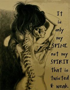 Vine Charcoal, Spinal Fusion, Spinal Surgery, Ehlers Danlos Syndrome, Spine Tattoo, Skeletal, Chronic Illness, Chronic Pain, Figure Drawing