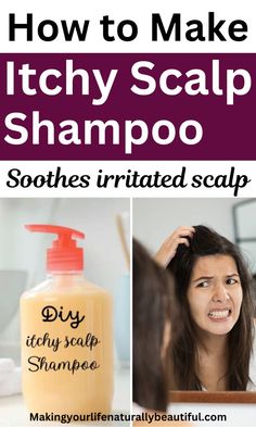 Soothe and calm itchy, irritated and dry scalp. Learn this simple recipe to make homemade shampoo for itchy scalp. Home remedies for itchy scalp. Diy shampoo recipe. Homemade soap recipes. Natural hair care. Dry scalp care. Itchy scalp care. Diy Shampoo Recipe Homemade, How To Treat Itchy Scalp, Scalp Cleanser Diy, Itchy Scalp Remedy Diy, Remedies For Itchy Scalp, Deb Hair, Make Shampoo, Itchy Scalp Remedy, Dry Scalp Remedy