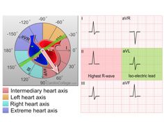 Heart Facts, Ekg Interpretation, Diagnostic Medical Sonography, Medical Videos, Cardiac Nursing, Medicine Student, Medical School Studying, Electrical Projects, Medical Knowledge