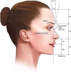 Orthognathic Surgery Before And After, Nose Surgery Rhinoplasty, Orthognathic Surgery, Rhinoplasty Nose Jobs, Pretty Nose, Facial Fillers, Perfect Nose