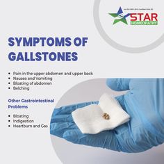 4 Effective Ways To Remove Tonsil Stones How To Get Rid Of Gallbladder Stones, Gallbladder Stones How To Get Rid, Gallstone Symptoms, Gallbladder Stones Diet, Nose Infection, Gallbladder Health