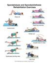 Spondylolysis & Spondylolisthesis Pain Exercises ~ It’s important to have strong muscles to support your spine. These exercises help build strong abdominal and back muscles. Diastasis Recti Exercises, Sciatica Exercises, Stomach Muscles, Pelvic Tilt, Lower Back Exercises, Muscle Strain, Health Information, Strong Muscles, Physical Therapist