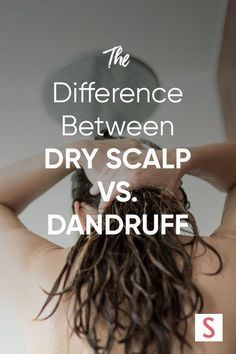 What Causes Dandruff, Best Shampoo For Dandruff, Dry Scalp Remedy, How To Treat Dandruff, Shampoo For Dry Scalp