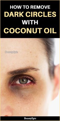 Concealer Tips, Remove Dark Circles, Dark Circles Under Eyes, Dark Circle, Eyes Problems, Health Planner, Eye Circles, Dry Eyes, Eye Care