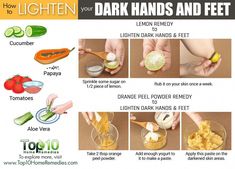 Dark hands and feet due to sun exposure and other factors can be lightened with medical and home treatments, along with self-care. Dark Spots On Legs, Skin Lightening Diy, Dark Hands, Dark Knuckles, Top 10 Home Remedies