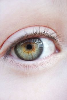 an eye looking at the camera with brown and yellow iris in it's center