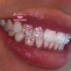 Tooth Gem Design Ideas, Piercing No Dente, Teeth Jewelry Tooth Gems, Teeth Gems Ideas, Tooth Gem Designs, Tooth Gems Aesthetic, Teeth Gems