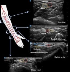 an x - ray image shows the location of radiographs in the abdomen and chest