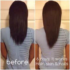 It Works! Hair Skin Nails: A Girl's Best Friend Hair Implants, Growing Your Hair Out, Nail Vitamins, Skin Nails, Grow Hair Faster