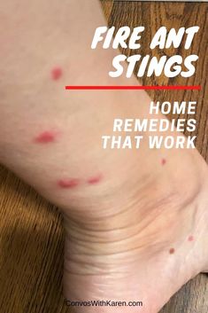 a person with red spots on their leg and foot that has the words, fire ant sting