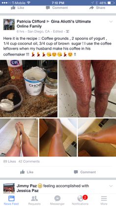 Tanning Hacks, Girl Tips Hygiene Kitty, Healthy Legs, Skin Aesthetic, Diy Beauty Treatments, Clear Skin Tips, Healthy Skin Tips