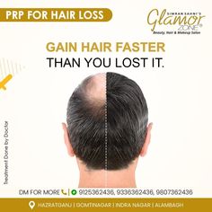 Gain Hair Faster Than You Lost It! PRP treatment at Glamor Zone . Contact us today and book your appointments Gomti Nagar- 9125362436 Hazratganj- 9336362436 Indira Nagar- 9807362436 -------- #lucknow #saloninLucknow #beauty #glamour #skincare #bestsaloninLucknow #lucknowsalon #salons #hairtreatment #makeup #PRPTreatment #PRP #chemicalpeels #hairproblems #lucknowcentre #dermatologist #hairstylist #HairSpa #hairstyles Prp For Hair, Hair Groth, Angel Video, Hair Growth Naturally, Hair Wellness, Prp Therapy, Hair Clinic, Aesthetic Clinic