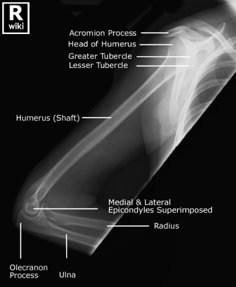 an x - ray shows the bones and their functions