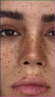 russian female model close portrait no makeup beauty summer freckles Full Face Freckles, Freckles Aesthetic Faceless, Lip Freckles, Freckles On Dark Skin, Face With Freckles, Models With Freckles, Nose Freckles, Freckle Skin, Freckles Beauty