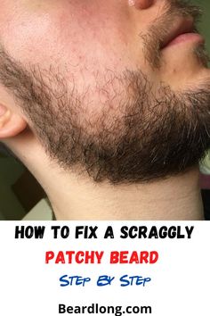 How To Grow A Beard Tips, Beard Maintenance Tips, Patchy Beard Growth Tips, Beard Styles For Patchy Beards, Beard Grooming Tips, Patchy Beard Styles For Men, Beard Growth Tips How To Grow, Beard Cut Styles For Men, How To Grow A Beard