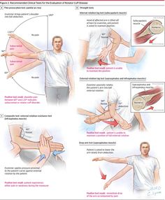 Shoulder Special Tests, Rotator Cuff Exercises Physical Therapy, Shoulder Pain Relief, Frozen Shoulder