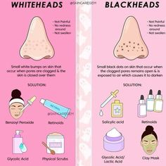 What To Do For Blackheads, Skincare Niacinamide, Obličejové Masky, Skin Hacks, Tone Makeup, Skincare Advice, Nose Makeup, Face Skin Care Routine, Skin Advice