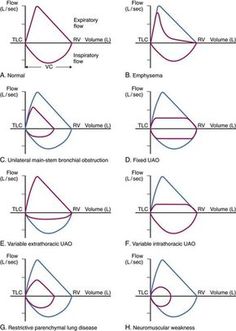 six diagrams showing the different angles and their corresponding shapes