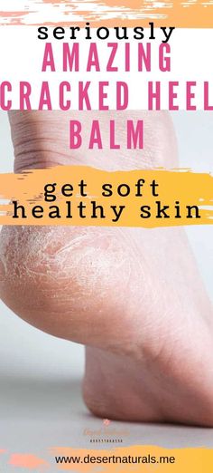 Foot Balm Recipe, Melaleuca Essential Oil, Heel Balm, Dry Cracked Heels, Dry Heels, Sweat Gland