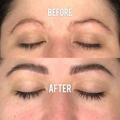 ForBrow | Eyebrow Growth Enhancing Serum by Forchics - ForChics Coffee Table Arrangment, Eyebrows Tutorial, Thicker Eyebrows, Bad Eyebrows, Brow Growth, Eyebrow Serum, Thick Brows, Benzalkonium Chloride, Eyebrow Growth