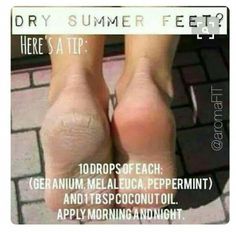 Heel Fissures, Doterra Oils Recipes, Esential Oils, Essential Oil Beauty, Doterra Oil, Doterra Essential Oils Recipes, Essential Oil Remedy, Restless Legs, Oil Remedies