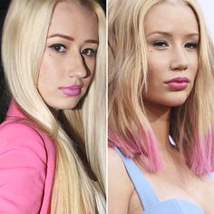 Iggy Azalea admits to getting a nose job! Natural Nose Job, Natural Nose, Nose Plastic Surgery, Lip Job, Botched Plastic Surgery, Feeling Ugly