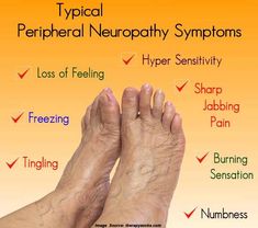 What is Neuropathy (Nerve Damage): Symptoms, Causes & Treatment Charcot Marie Tooth, Guillain Barre, Nerve Health, Nerve Pain Relief, Nerve Damage, Joints Pain Relief, Nerve Pain, Chronic Fatigue, Foot Pain