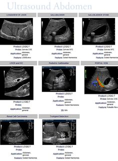 an x - ray shows the different types of utrasound abomen, including