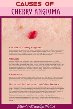 Cherry Angioma, Mole Meaning, Red Moles, Healthy Life Hacks, Healthy Lifestyle Quotes, Blood Sugar Diet, Body Cells, Hygiene Routine