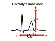 an electrolyte imalance is shown in the diagram below