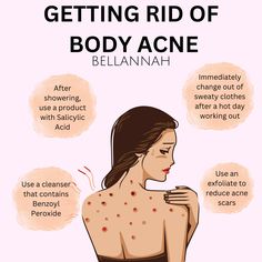 Getting Rid Of Body Acne How To Rid Of Acne, How To Get Rid Of Body Acne Fast, Acne On Back How To Get Rid, Things To Get Rid Of Acne, Different Types Of Acne How To Get Rid, How To Get Rid Of Back Acne Naturally, How To Get Rid Of Scars On Face From Acne, Tips For Back Acne, How To Hide A Body Tips