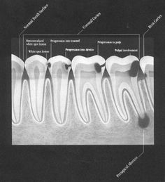 Dental Images, Dental Posts, Dental Videos