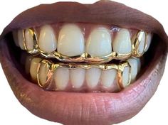 Grillz Girls Teeth, Girl Grillz Gold Grill, Mouth Jewelry Teeth, Grillz Black Female, Gold Grillz Aesthetic, Front Teeth Grillz, Cool Grills Teeth, Emerald Grillz, Golds On Black Women Teeth