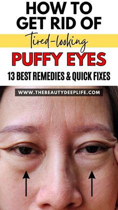 Bye-Bye Puffy Eyes: Simple Solutions for Tired-Looking Eyes How To Depuff Eyes, Eye Bag Remedies, At Home Skincare, Skin Home Remedies, Skin Care At Home, Puffy Eyes Remedy, Baggy Eyes, Skin Care Home Remedies, Skincare Solutions